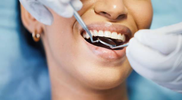 Best Emergency Cosmetic Dentistry in Aledo, TX