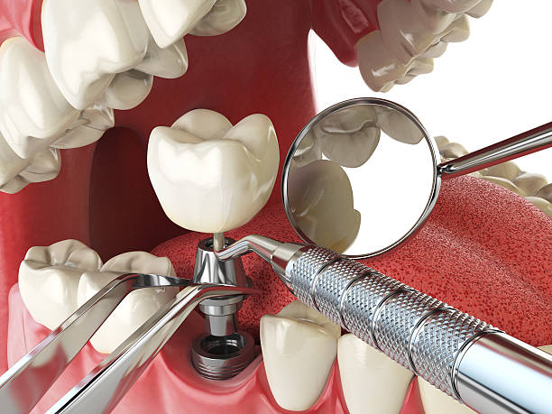Best Holiday Emergency Dentist in Aledo, TX