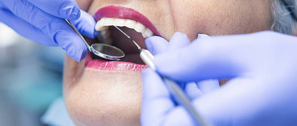 Best Emergency Root Canal Treatment in Aledo, TX